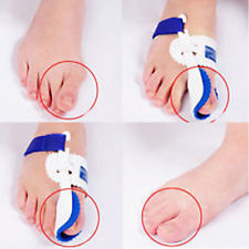 Médico de Hallux Valgus ortesis pie <span class=keywords><strong>juanete</strong></span> férula - Product Image 3