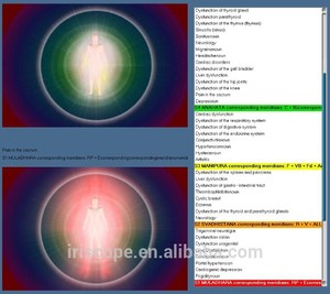 <span class=keywords><strong>8d</strong></span> <span class=keywords><strong>nls</strong></span> - Product Image 1