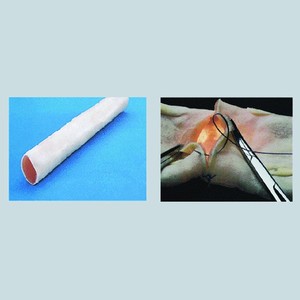 Anastomosis ADA-LV7, modelo de enseñanza, ciencia médica, Humana - Product Image 2