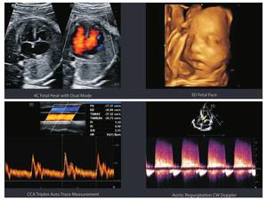 Medsinglong instruments à ultrasons médicaux machine à ultrasons ecocardiografo corazon portable 3d 4d 5d chariot scanner à ultrasons - Product Image 2