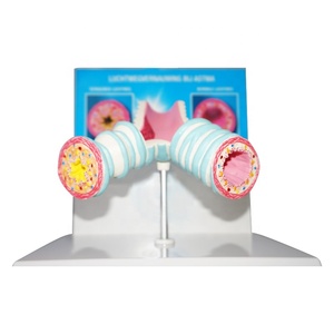 <span class=keywords><strong>Model</strong></span> asma produk perbandingan kesehatan dan sakit Bronchi - Product Image 1