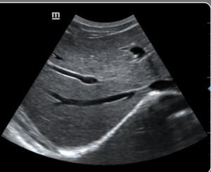 Preço da máquina de ultra-sonografia <span class=keywords><strong>Mindray</strong></span> <span class=keywords><strong>dc</strong></span> 30/trolly carrinho - Product Image 3