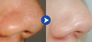 Thanh Xà Phòng Tự Làm Làm Trắng Da Dê - Product Image 5