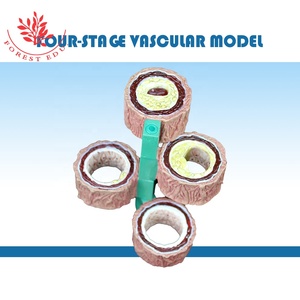 <span class=keywords><strong>Arteriosclerosis</strong></span> <span class=keywords><strong>enfermedad</strong></span> cardiovascular 4 unidades patología humana arteria modelo - Product Image 2