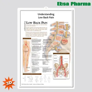 3D Medische Menselijk Anatomie Wandplaten/Poster-Begrip Lage Rugpijn