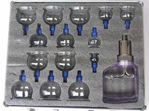 Europaweit Beliebtes Bestseller Vakuum-Hijama-Schröpfgläser-Set, 14-teiliger Koffer - Product Image 5