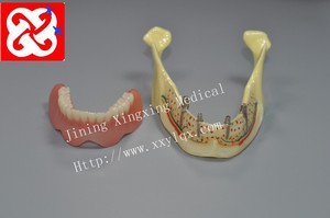 Prothese implantaat en restauratie anatomisch kaak model - Product Image 4