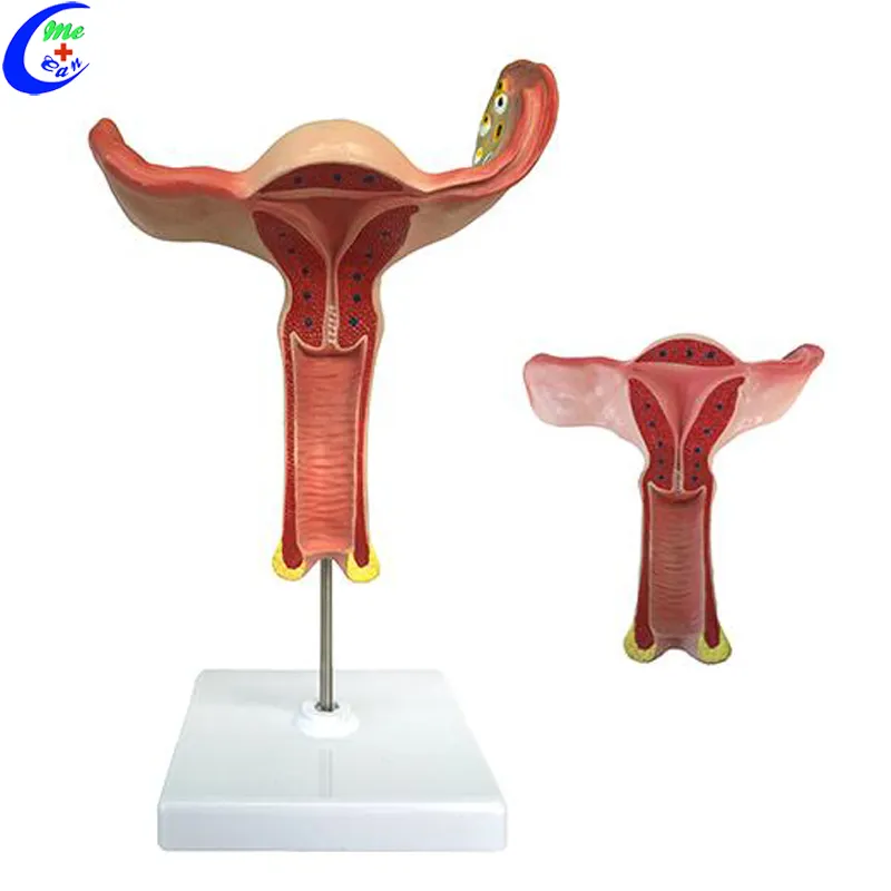 의료 해부학 자궁 모형