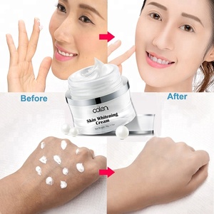 OALEN marca blanca Corea 50g hidratante eliminación de <span class=keywords><strong>manchas</strong></span> oscuras instantánea mejor crema facial <span class=keywords><strong>para</strong></span> blanquear <span class=keywords><strong>la</strong></span> piel - Product Image 4