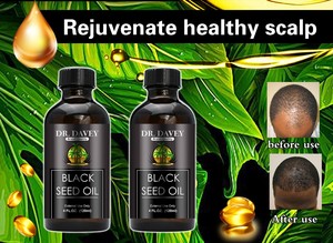 Dầu Mọc Tóc Dừa Hạt Đen Thầu Dầu DAVEY Jamaica OEM/ODM Nhãn Hiệu Riêng Chấp Nhận Được - Product Image 6