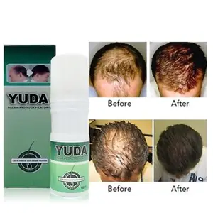 For bald head men yuda hair growth spray  grow new hair spray best hair oils 2018 effective for twice a day 5-6 times each and time