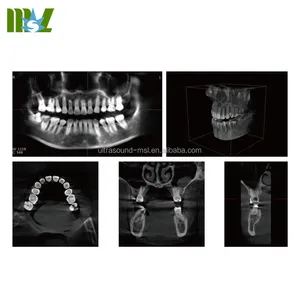 MSLPX30 Dental CBCT Kerucut Balok Komputasi Sistem Tomografi