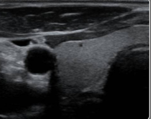 Máy siêu âm Doppler màu <span class=keywords><strong>4D</strong></span> Mindray Mindray Dc-30 - Product Image 3