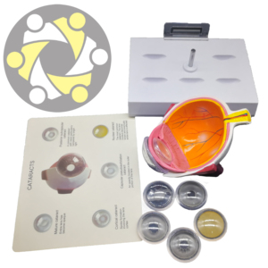 Mô Hình Giảng Dạy Của Mắt Đục Thủy Tinh Thể Bằng Nhựa Mở Rộng Sáu Lần - Product Image 4