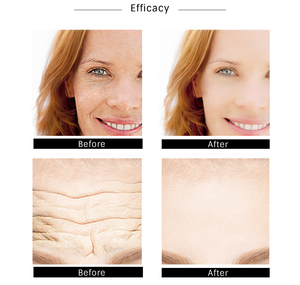 Suero Facial Hidratante de Colágeno con Oro de 24K Omy Lady Skincare al por Mayor para Marca Privada - Product Image 6