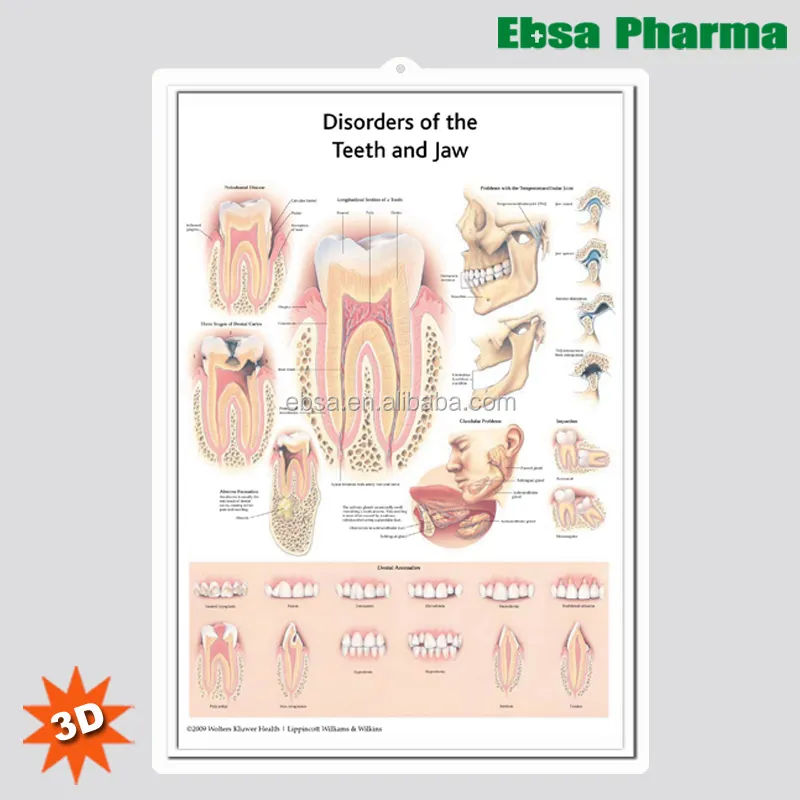 3D Medizinische Menschlichen Anatomie Wand Charts/Poster-Störungen der Zähne und Kiefer