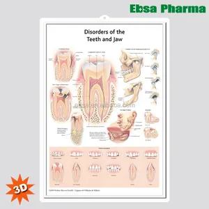 3D Medical Human Anatomy Wall charms/Poster-desajustes de los dientes y la mandíbula