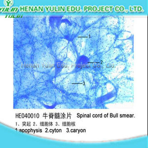 Mejor <span class=keywords><strong>Precio</strong></span> en Cordón Espinal T.S. Diapositivas de Histología Preparadas para Fines Educativos, Regalos de Biología para Adultos y Niños - Product Image 6