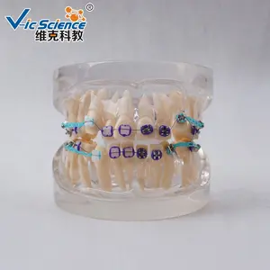 24 Stuks Plastic Menselijke Levensgrote Tandheelkundige Leer Ortho Keramische Beugel Tanden Model Medisch Anatomisch Model