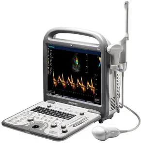 Echo จีนแบบพกพา Doppler ultrasound เครื่อง S8 สำหรับขาย