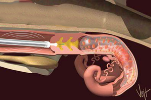 Pistola de Inseminación Visual para <span class=keywords><strong>Vacas</strong></span>/Caballos - Product Image 5