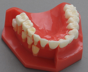 Mixed Dentition Pediatric Development Model for Demonstration at <strong>Age</strong> 9-12 - Product Image 4