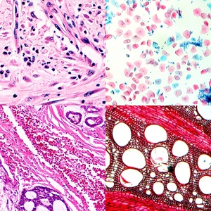 OPTO-EDU A12.2603-T 40x-1000x Trinocular 실험실 생물학 현미경 가격 - Product Image 3