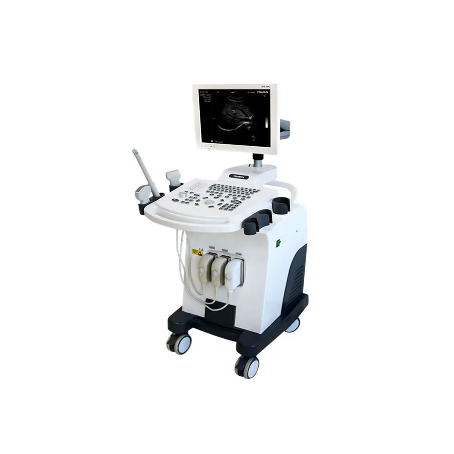อุปกรณ์อัลตราซาวด์ทางการแพทย์ของจีนและเครื่อง Sonography