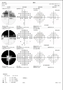 Analizador de computadora óptica Eye Perimeter Visual Field ZW-850A - Product Image 6