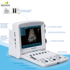 Bon <span class=keywords><strong>prix</strong></span> 12.1 "Machine à ultrasons Doppler couleur EDAN U50 portable pour homme - Product Image 2