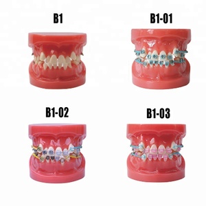Modèle Standard dents prothèse orthodontique pour l'enseignement - Product Image 1