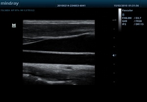 เครื่องอัลตราซาวด์พกพา Mindray DP-50 คุณภาพเยี่ยม ระบบขาวดำ - Product Image 6