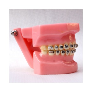 Modello dentale Ortodontico Con staffe in metallo - Product Image 3