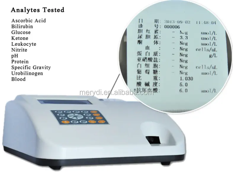 Nước tiểu analyzer, bán tự động lâm sàng hóa học máy phân tích, W-