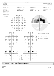Analizador de computadora óptica Eye Perimeter Visual Field ZW-850A - Product Image 5