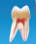 Modèle endo de formation, dispositif de couverture des dents à cavités