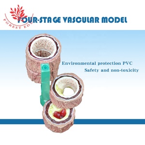 «<span class=keywords><strong>Cardiovascular</strong></span> doença 4 peças modelo de patologia humana <span class=keywords><strong>arterial</strong></span> - Product Image 3
