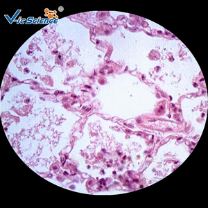Lames préparées pour microscope 200 pièces diapositives éducatives lames de microscope de pathologie humaine ensemble de pathologie scientifique médicale - Product Image 5