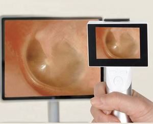 FarmaS ino medizinische Endoskop kamera tragbare digitale Otoskop kamera digitale Laryngoskop kamera - Product Image 3