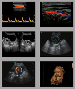 Sonoscope S9 de qualité supérieure avec certificat CE, machine découpeuse à ultrasons portable,