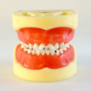 Dentaire dents modèle Caries des enfants