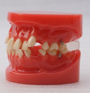 Dentale Ortodontico denti modello - Product Image 3