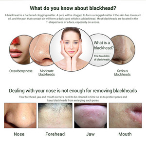 Mascarilla Facial <span class=keywords><strong>Negra</strong></span> de Carbón Natural Bioaqua OEM ODM para Limpieza Profunda del Rostro - Product Image 3