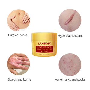 LANBENA stretch mark acné cicatriz eliminación crema pockmark de reparación - Product Image 5