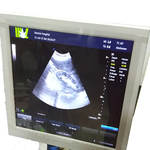 3D 4D Volledig Digitale Trolley Kleur Doppler Ultrasound Scanner - Product Image 2