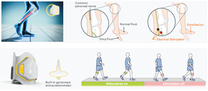 Perangkat Perawatan Perangsang Listrik Fungsional Disetujui <span class=keywords><strong>CE</strong></span>