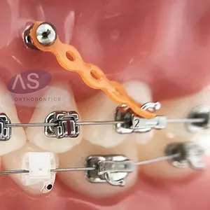 Tube buccal orthodontique Convertible