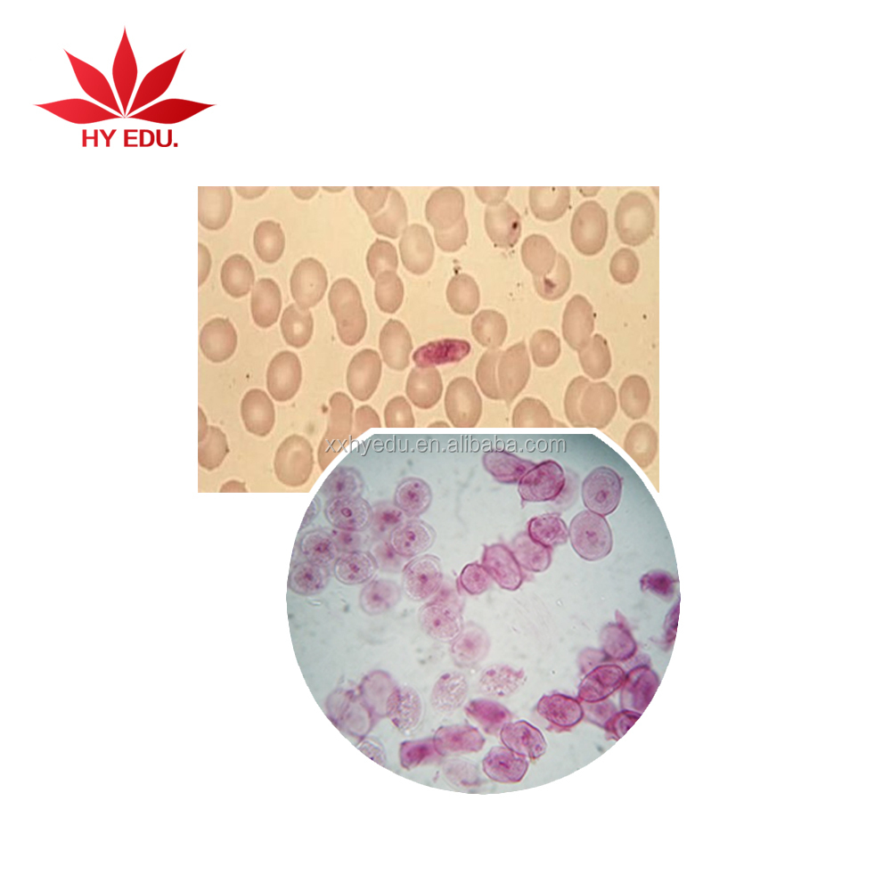 Подготовленные для микроскопа слайды, набор медицинских паразитологических слайдов
