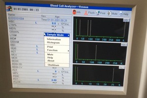 Klinische <span class=keywords><strong>Routine</strong></span> Testen Bloed Analyze CBC-6000 - Product Image 2