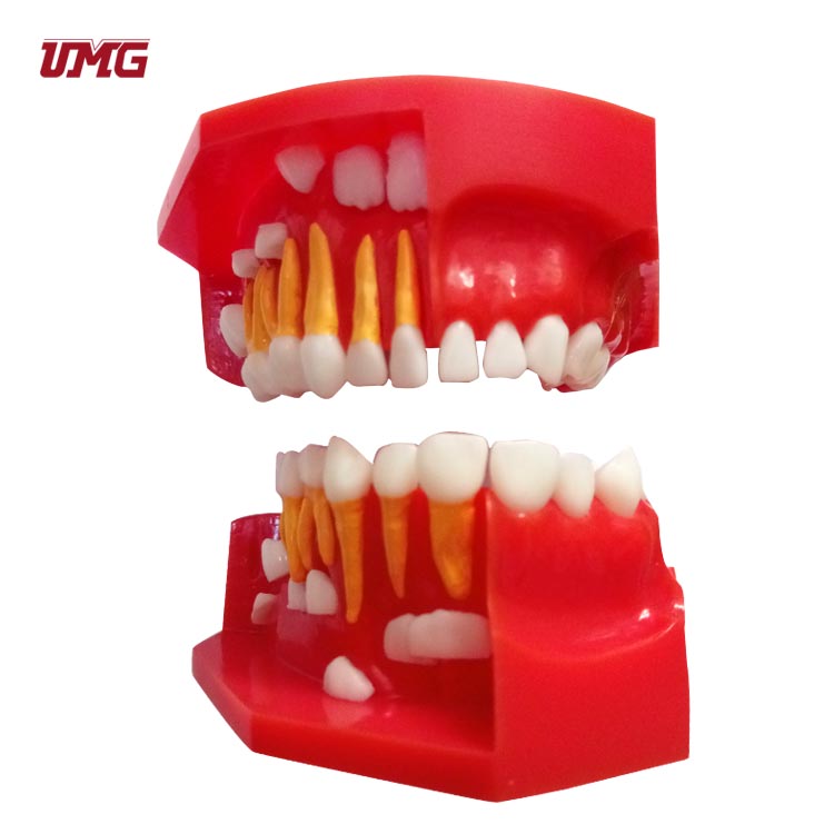 Детское молоко перманентные зубы первичная и Перманентная чередующая анатомическая модель